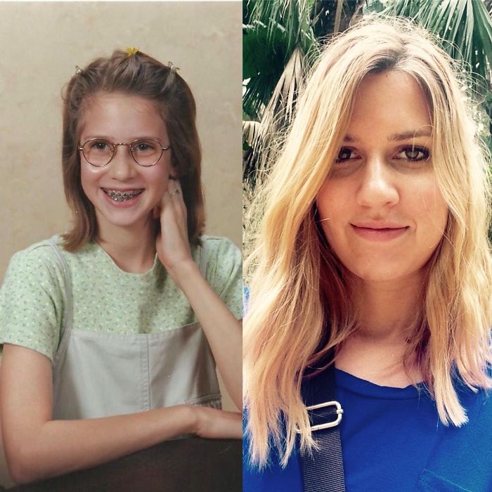 People Share Their Incredible “Ugly Duckling” Transformations And It’s Hard To Believe They’re The Same People People Share Their Incredible “Ugly Duckling” Transformations And It’s Hard To Believe They’re The Same People