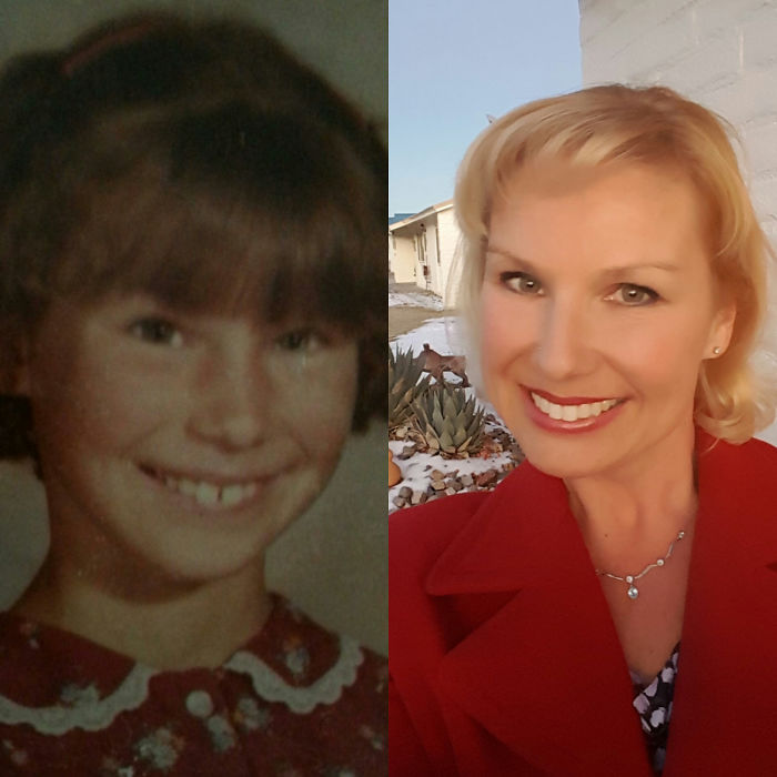 People Share Their Incredible “Ugly Duckling” Transformations And It’s Hard To Believe They’re The Same People People Share Their Incredible “Ugly Duckling” Transformations And It’s Hard To Believe They’re The Same People