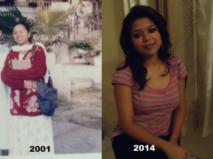 People Share Their Incredible “Ugly Duckling” Transformations And It’s Hard To Believe They’re The Same People People Share Their Incredible “Ugly Duckling” Transformations And It’s Hard To Believe They’re The Same People