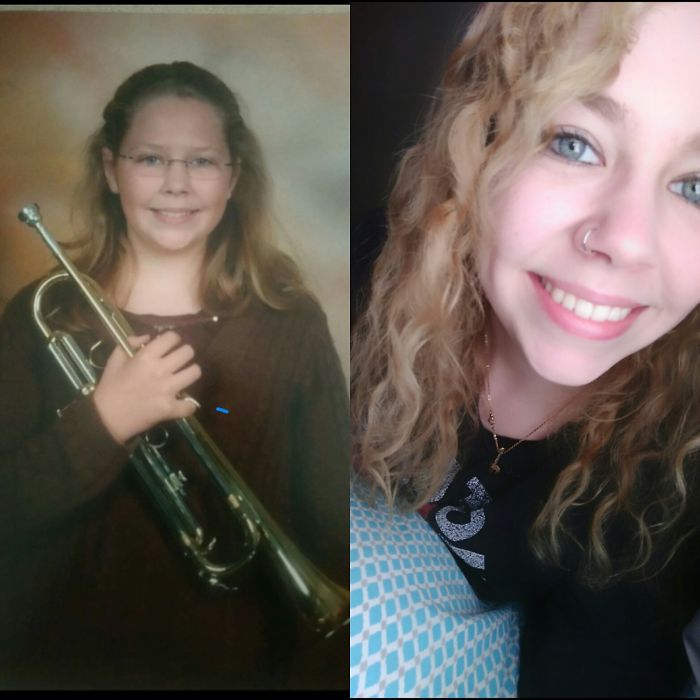 People Share Their Incredible “Ugly Duckling” Transformations And It’s Hard To Believe They’re The Same People People Share Their Incredible “Ugly Duckling” Transformations And It’s Hard To Believe They’re The Same People