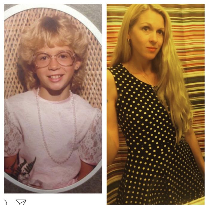 People Share Their Incredible “Ugly Duckling” Transformations And It’s Hard To Believe They’re The Same People People Share Their Incredible “Ugly Duckling” Transformations And It’s Hard To Believe They’re The Same People