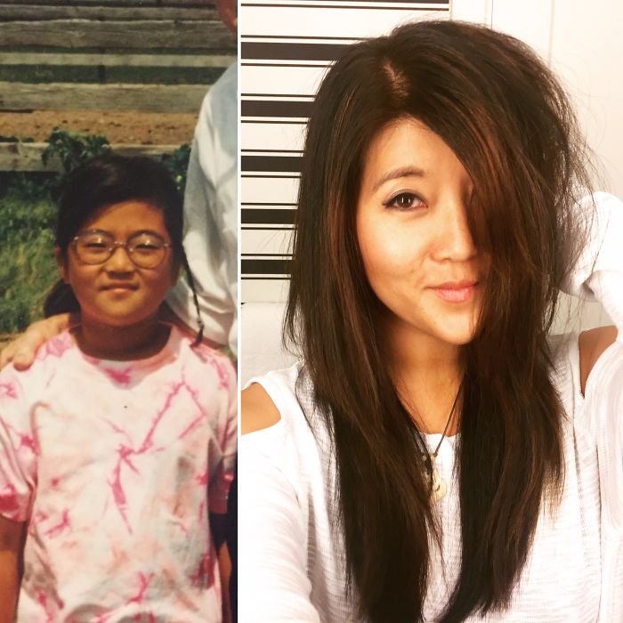 People Share Their Incredible “Ugly Duckling” Transformations And It’s Hard To Believe They’re The Same People People Share Their Incredible “Ugly Duckling” Transformations And It’s Hard To Believe They’re The Same People
