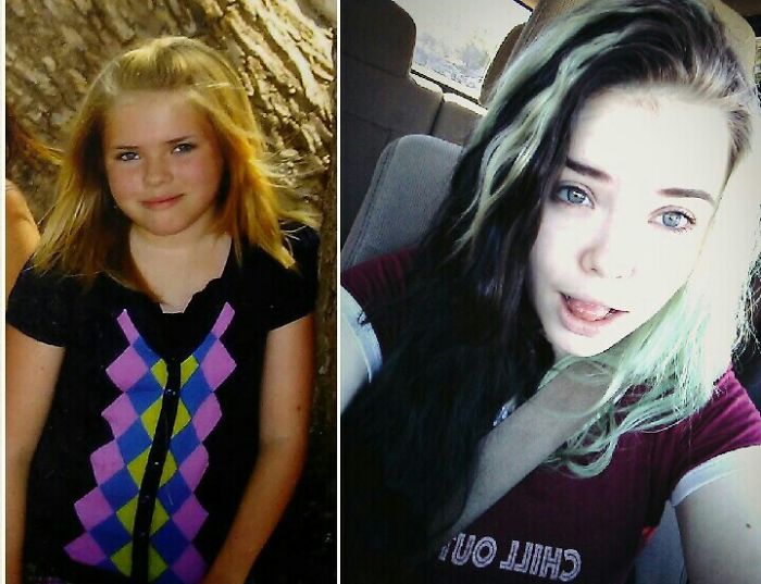People Share Their Incredible “Ugly Duckling” Transformations And It’s Hard To Believe They’re The Same People People Share Their Incredible “Ugly Duckling” Transformations And It’s Hard To Believe They’re The Same People