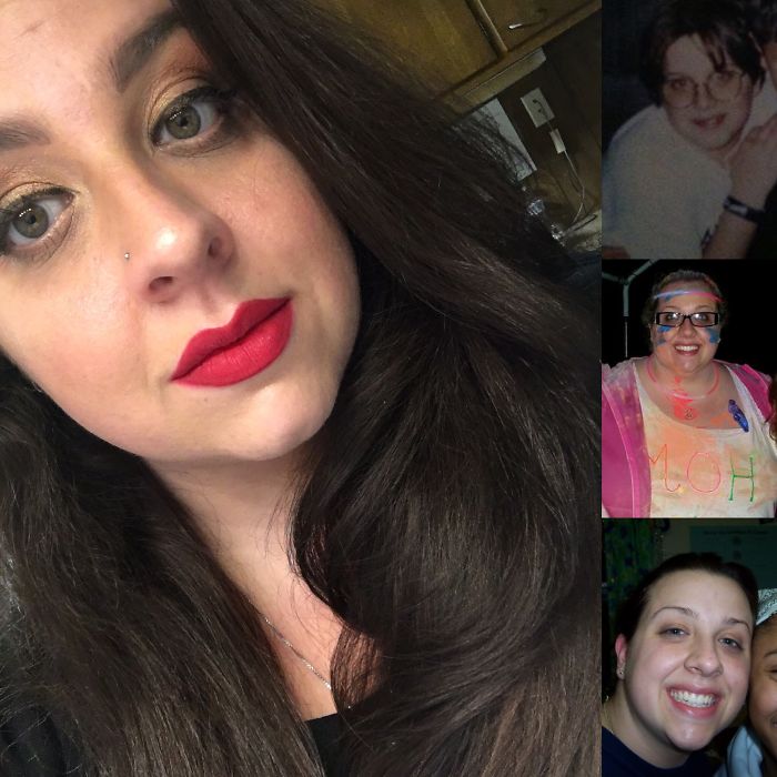 People Share Their Incredible “Ugly Duckling” Transformations And It’s Hard To Believe They’re The Same People People Share Their Incredible “Ugly Duckling” Transformations And It’s Hard To Believe They’re The Same People