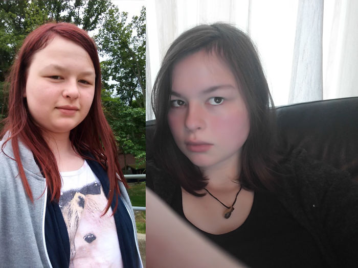 People Share Their Incredible “Ugly Duckling” Transformations And It’s Hard To Believe They’re The Same People People Share Their Incredible “Ugly Duckling” Transformations And It’s Hard To Believe They’re The Same People