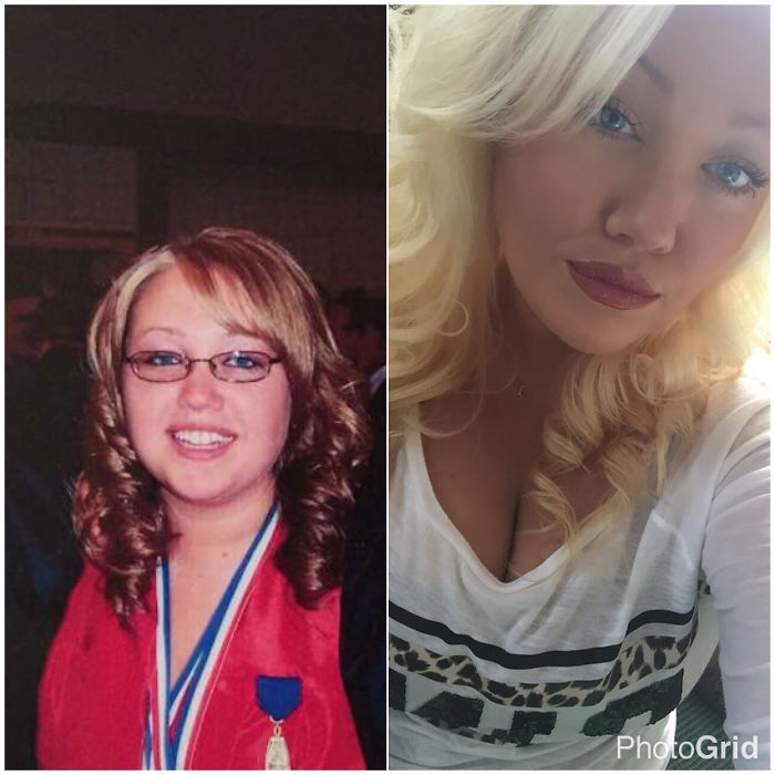People Share Their Incredible “Ugly Duckling” Transformations And It’s Hard To Believe They’re The Same People People Share Their Incredible “Ugly Duckling” Transformations And It’s Hard To Believe They’re The Same People