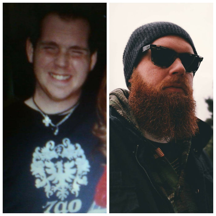 People Share Their Incredible “Ugly Duckling” Transformations And It’s Hard To Believe They’re The Same People People Share Their Incredible “Ugly Duckling” Transformations And It’s Hard To Believe They’re The Same People