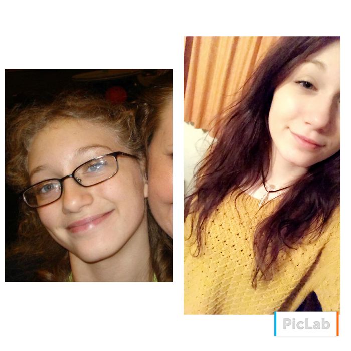 People Share Their Incredible “Ugly Duckling” Transformations And It’s Hard To Believe They’re The Same People People Share Their Incredible “Ugly Duckling” Transformations And It’s Hard To Believe They’re The Same People