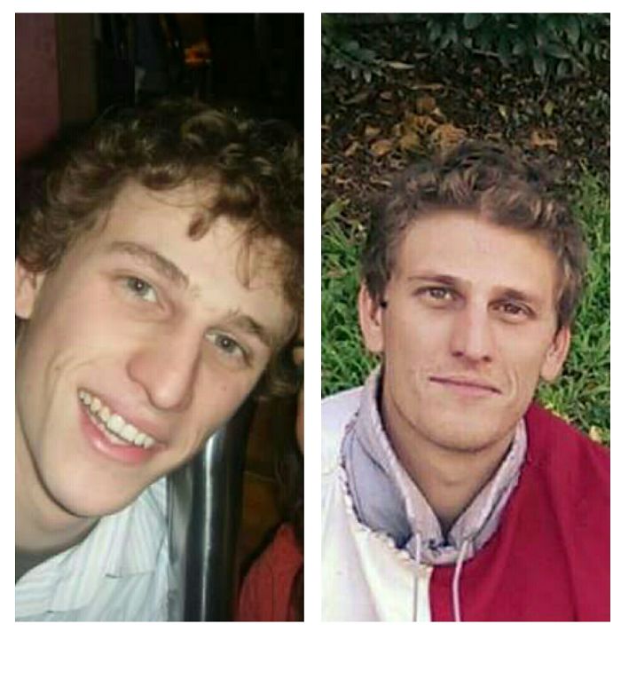 People Share Their Incredible “Ugly Duckling” Transformations And It’s Hard To Believe They’re The Same People People Share Their Incredible “Ugly Duckling” Transformations And It’s Hard To Believe They’re The Same People