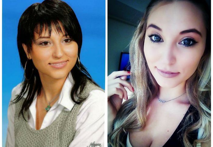 People Share Their Incredible “Ugly Duckling” Transformations And It’s Hard To Believe They’re The Same People People Share Their Incredible “Ugly Duckling” Transformations And It’s Hard To Believe They’re The Same People