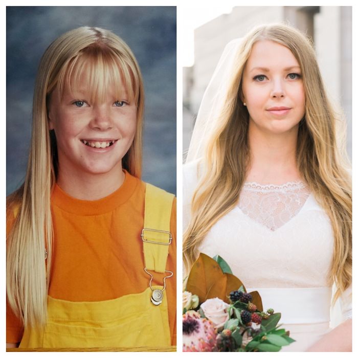 People Share Their Incredible “Ugly Duckling” Transformations And It’s Hard To Believe They’re The Same People People Share Their Incredible “Ugly Duckling” Transformations And It’s Hard To Believe They’re The Same People