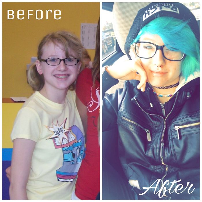 People Share Their Incredible “Ugly Duckling” Transformations And It’s Hard To Believe They’re The Same People People Share Their Incredible “Ugly Duckling” Transformations And It’s Hard To Believe They’re The Same People