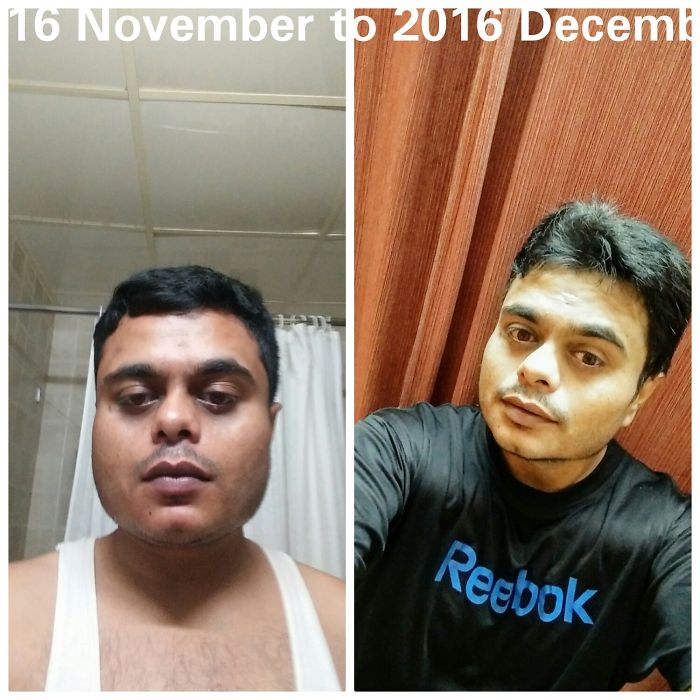 People Share Their Incredible “Ugly Duckling” Transformations And It’s Hard To Believe They’re The Same People People Share Their Incredible “Ugly Duckling” Transformations And It’s Hard To Believe They’re The Same People