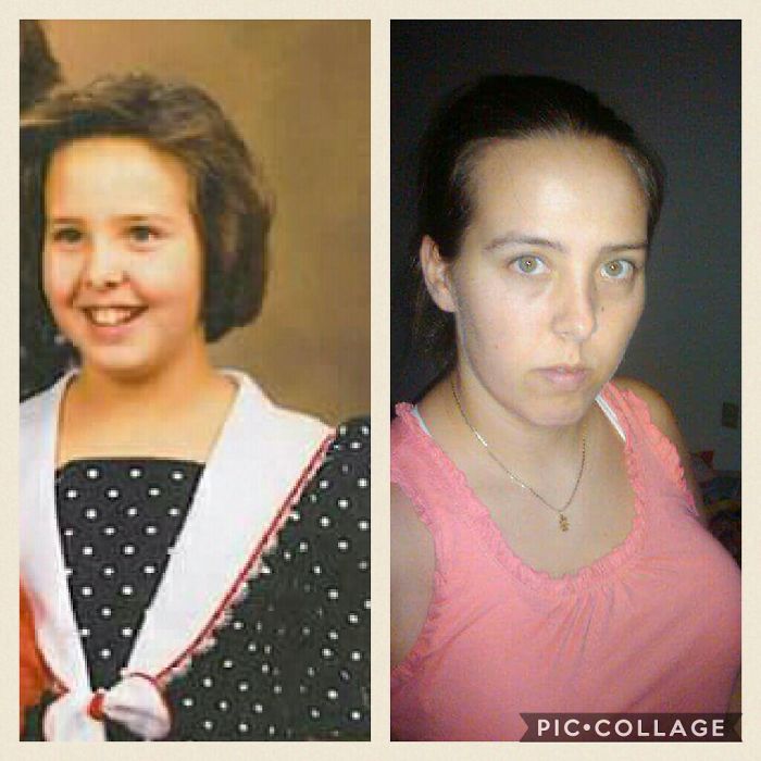 People Share Their Incredible “Ugly Duckling” Transformations And It’s Hard To Believe They’re The Same People People Share Their Incredible “Ugly Duckling” Transformations And It’s Hard To Believe They’re The Same People