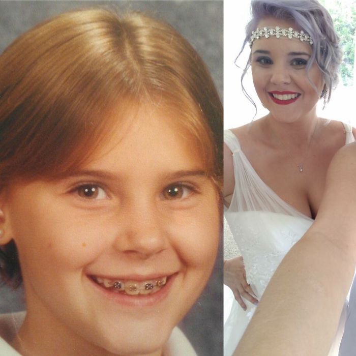 People Share Their Incredible “Ugly Duckling” Transformations And It’s Hard To Believe They’re The Same People People Share Their Incredible “Ugly Duckling” Transformations And It’s Hard To Believe They’re The Same People