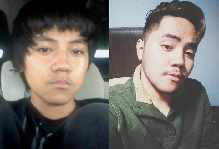 People Share Their Incredible “Ugly Duckling” Transformations And It’s Hard To Believe They’re The Same People People Share Their Incredible “Ugly Duckling” Transformations And It’s Hard To Believe They’re The Same People