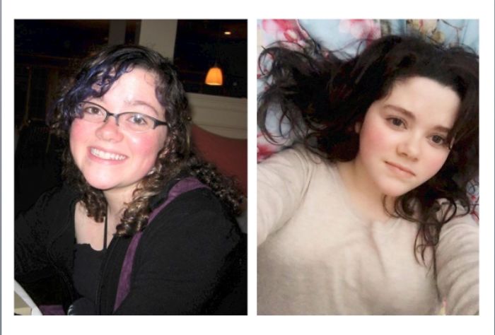 People Share Their Incredible “Ugly Duckling” Transformations And It’s Hard To Believe They’re The Same People People Share Their Incredible “Ugly Duckling” Transformations And It’s Hard To Believe They’re The Same People