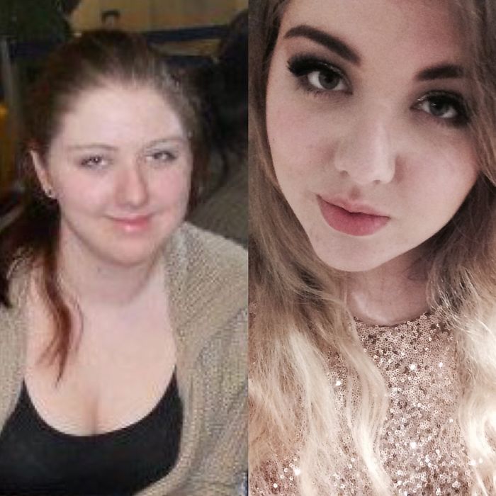 People Share Their Incredible “Ugly Duckling” Transformations And It’s Hard To Believe They’re The Same People People Share Their Incredible “Ugly Duckling” Transformations And It’s Hard To Believe They’re The Same People
