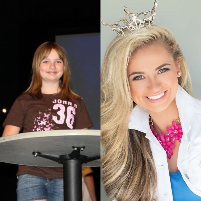 People Share Their Incredible “Ugly Duckling” Transformations And It’s Hard To Believe They’re The Same People People Share Their Incredible “Ugly Duckling” Transformations And It’s Hard To Believe They’re The Same People