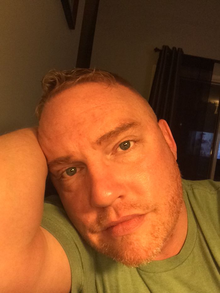 People Share Their Incredible “Ugly Duckling” Transformations And It’s Hard To Believe They’re The Same People People Share Their Incredible “Ugly Duckling” Transformations And It’s Hard To Believe They’re The Same People