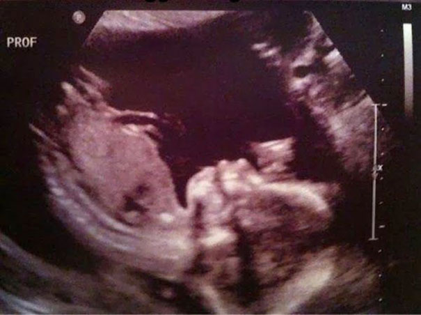 81 Pics That’ll Freak You Out WHEN YOU SEE IT 81 Pics That’ll Freak You Out WHEN YOU SEE IT