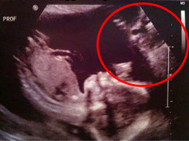 81 Pics That’ll Freak You Out WHEN YOU SEE IT 81 Pics That’ll Freak You Out WHEN YOU SEE IT