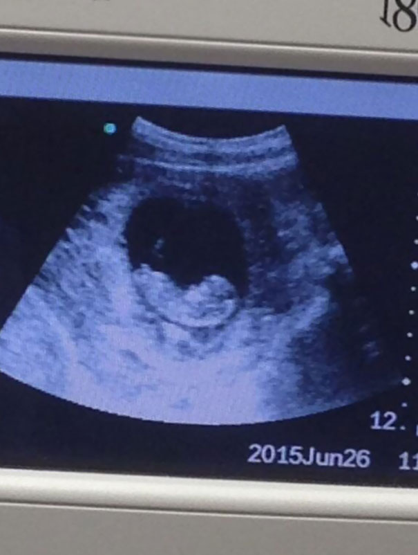 81 Pics That’ll Freak You Out WHEN YOU SEE IT 81 Pics That’ll Freak You Out WHEN YOU SEE IT