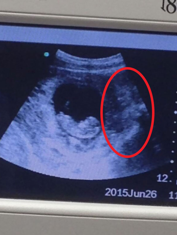 81 Pics That’ll Freak You Out WHEN YOU SEE IT 81 Pics That’ll Freak You Out WHEN YOU SEE IT