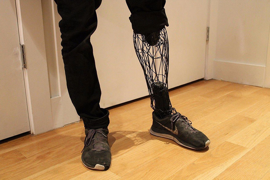 Incredible See-Through Prosthetics 3D-Printed From Titanium Incredible See-Through Prosthetics 3D-Printed From Titanium