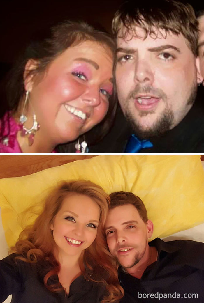 65 Before-And-After Pics Show What Happens When You Stop Drinking (Part 2)