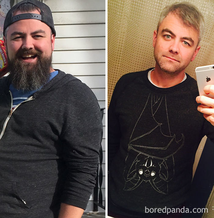 65 Before-And-After Pics Show What Happens When You Stop Drinking (Part 2)