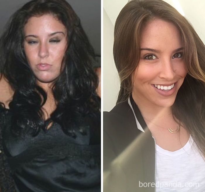 65 Before-And-After Pics Show What Happens When You Stop Drinking (Part 2)