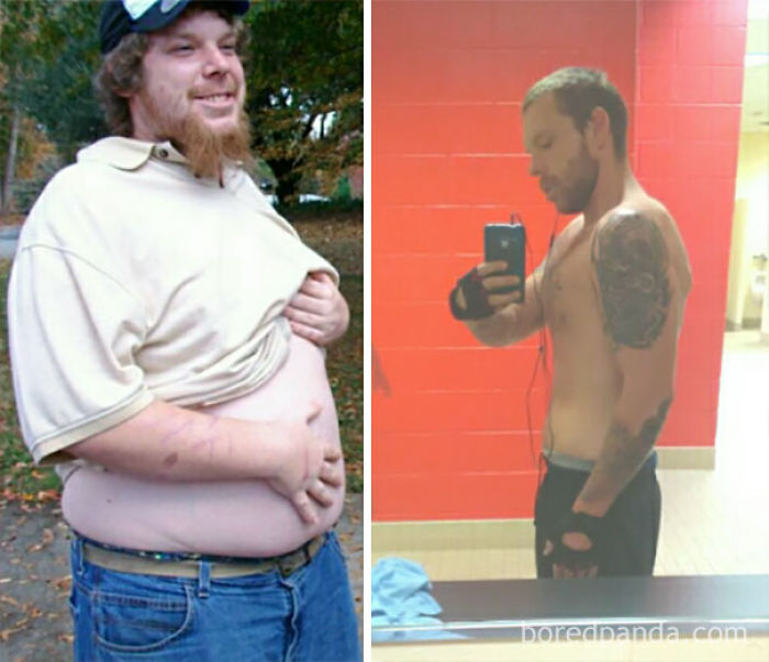 65 Before-And-After Pics Show What Happens When You Stop Drinking (Part 2)