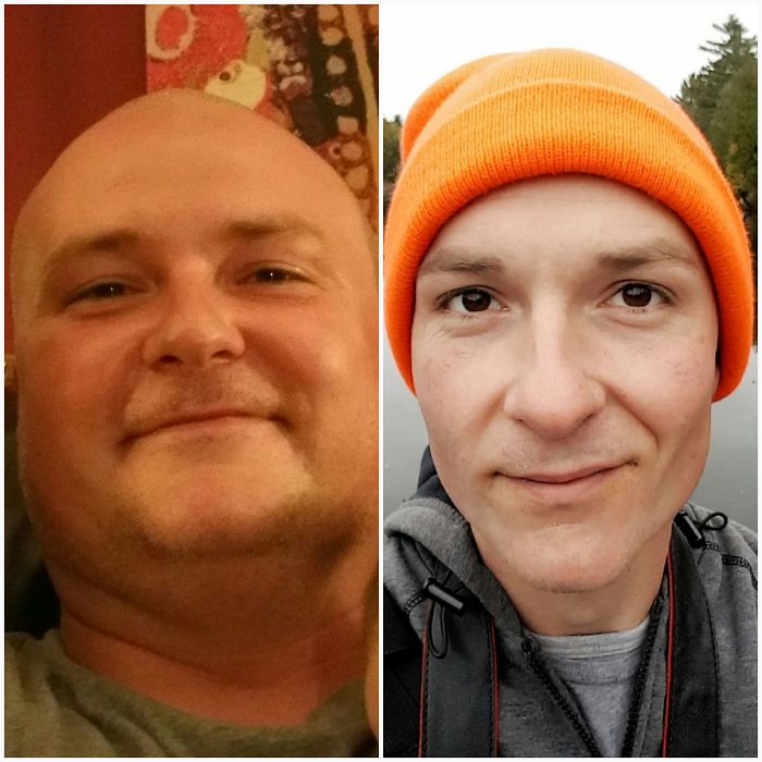 65 Before-And-After Pics Show What Happens When You Stop Drinking (Part 2) 65 Before-And-After Pics Show What Happens When You Stop Drinking (Part 2)