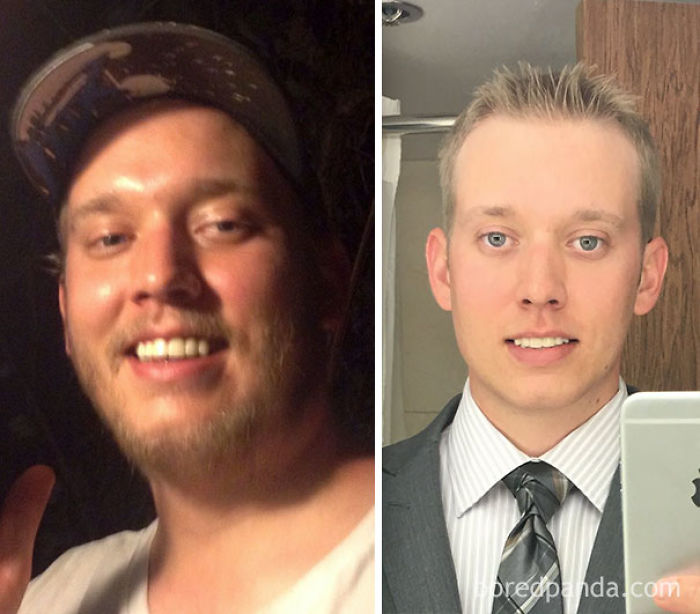 65 Before-And-After Pics Show What Happens When You Stop Drinking (Part 2)