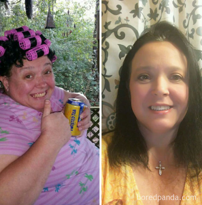 65 Before-And-After Pics Show What Happens When You Stop Drinking (Part 2)
