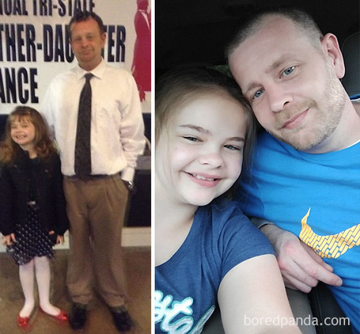 65 Before-And-After Pics Show What Happens When You Stop Drinking (Part 2)