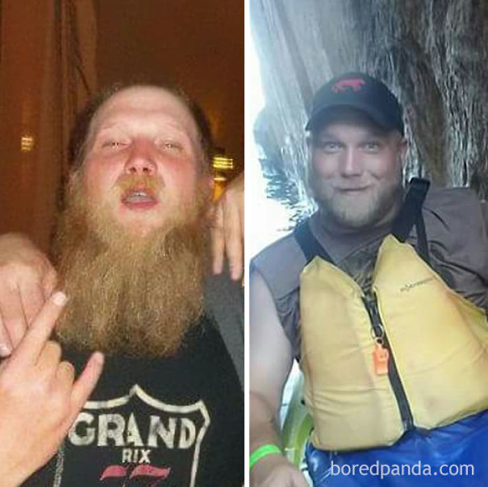 65 Before-And-After Pics Show What Happens When You Stop Drinking (Part 2)