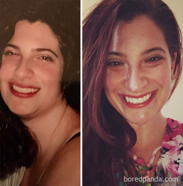 65 Before-And-After Pics Show What Happens When You Stop Drinking (Part 2)