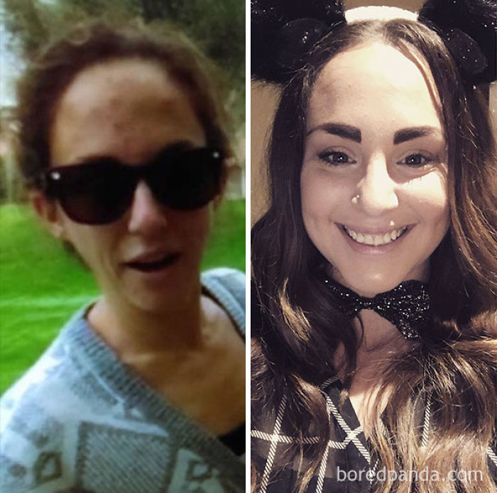 65 Before-And-After Pics Show What Happens When You Stop Drinking (Part 2)