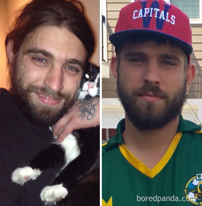 65 Before-And-After Pics Show What Happens When You Stop Drinking (Part 2) 65 Before-And-After Pics Show What Happens When You Stop Drinking (Part 2)