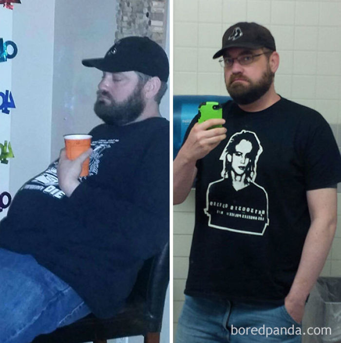 65 Before-And-After Pics Show What Happens When You Stop Drinking (Part 2)