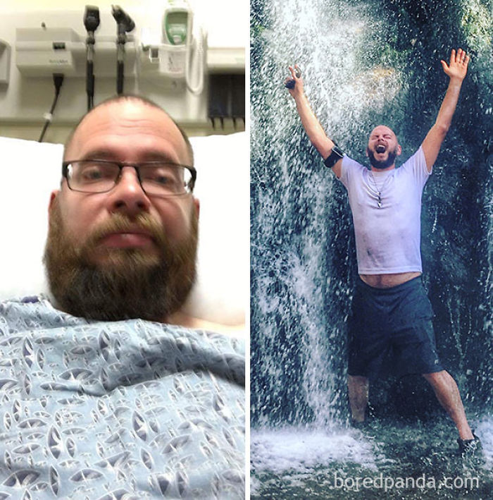 65 Before-And-After Pics Show What Happens When You Stop Drinking (Part 2)