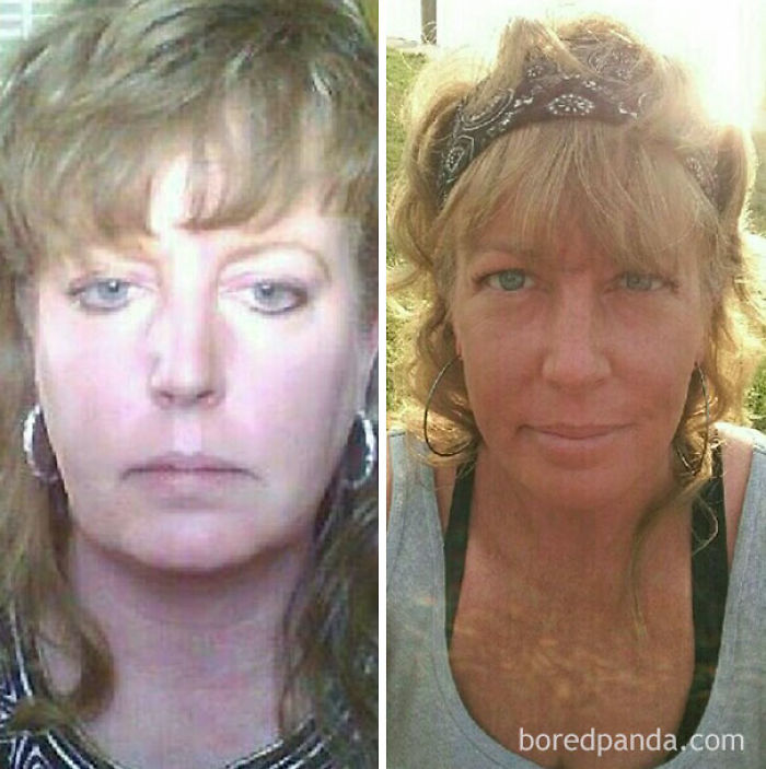 65 Before-And-After Pics Show What Happens When You Stop Drinking (Part 2) 65 Before-And-After Pics Show What Happens When You Stop Drinking (Part 2)