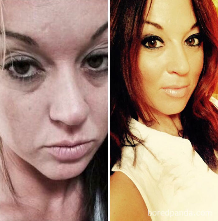 65 Before-And-After Pics Show What Happens When You Stop Drinking (Part 2)