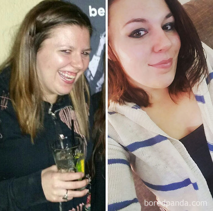 65 Before-And-After Pics Show What Happens When You Stop Drinking (Part 2)
