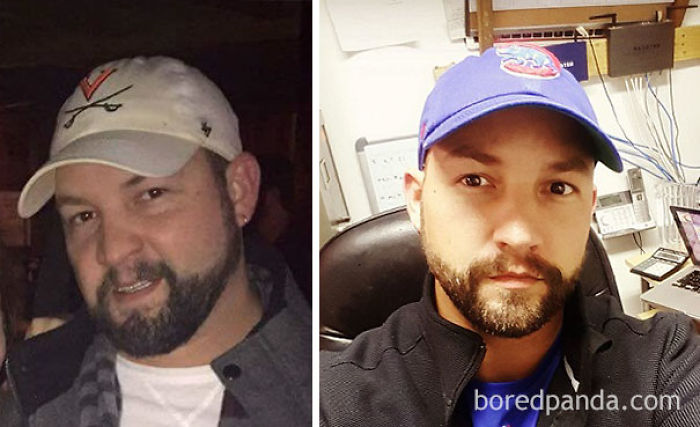 65 Before-And-After Pics Show What Happens When You Stop Drinking (Part 2)