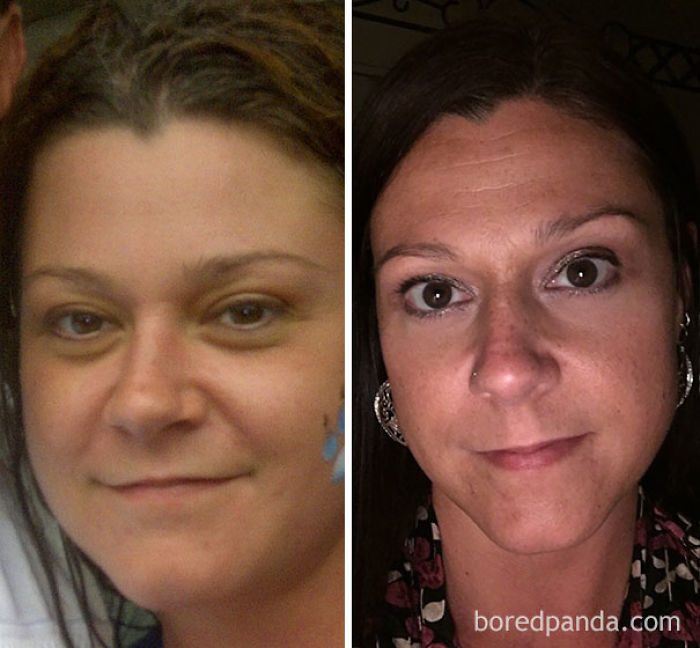 65 Before-And-After Pics Show What Happens When You Stop Drinking (Part 2) 65 Before-And-After Pics Show What Happens When You Stop Drinking (Part 2)