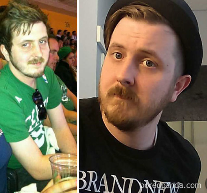 65 Before-And-After Pics Show What Happens When You Stop Drinking (Part 2)