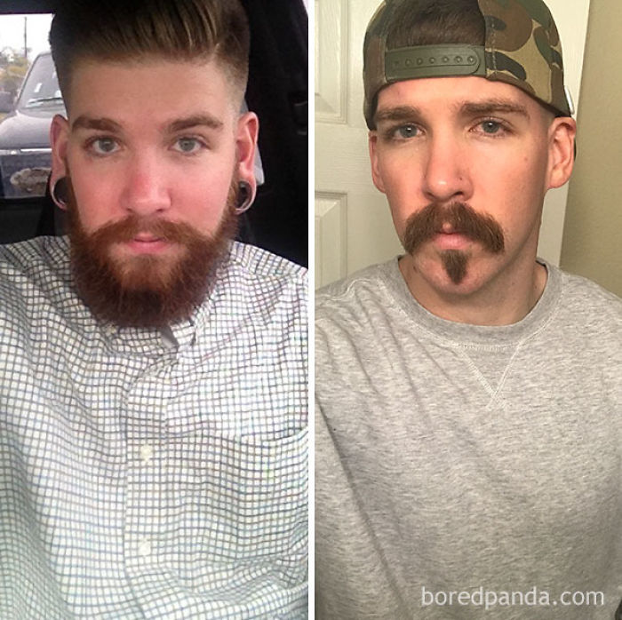 65 Before-And-After Pics Show What Happens When You Stop Drinking (Part 2)